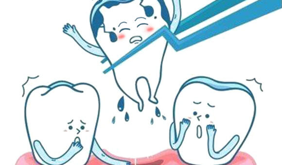 深圳拔牙